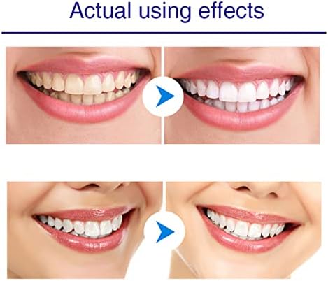 Писалка за избелване на зъбите (5 бр.), Използвайте два пъти на ден, че зъбите са станали значително по-бели